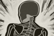 spine and head graphic